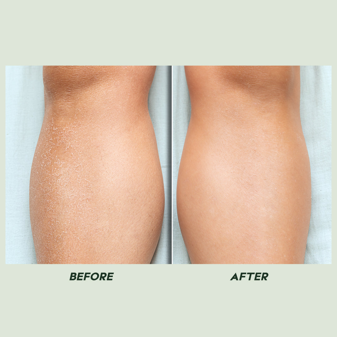 Trulysage Amrut Aloe Vitamin E Body Lotion | 24-Hour Hydration & Skin Repair | Lightweight & Non-Greasy | Aloe Vera & Vitamin E | 200ml