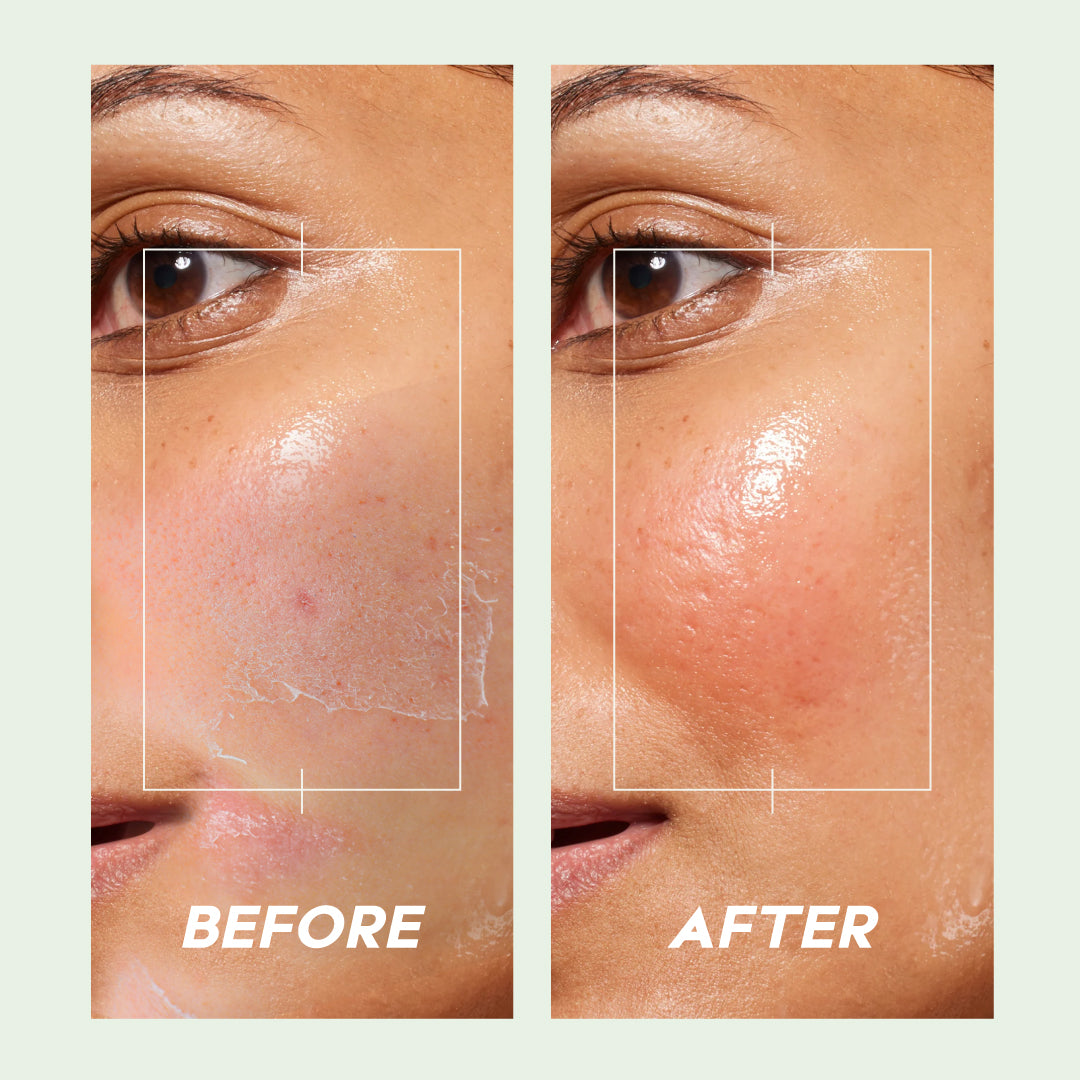 Trulysage Kesarbala Cold Cream | Winter Skincare Essential | Deep Moisturization & Skin Repair | Saffron, Almond Oil & Honey | 100ml