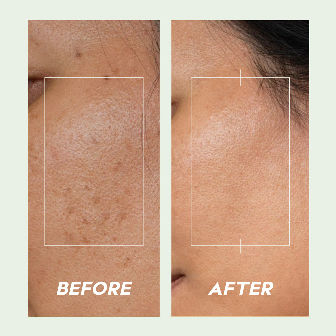 Trulysage Ujjwal Walnut Scrub for Face & Body | Gentle Exfoliation & Skin Brightening | Walnut Beads & Licorice | 100ml