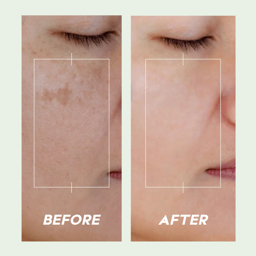 Trulysage Tejaswini Brightening Cream | Saffron, Turmeric & Vitamin C | Reduces Dark Spots & Pigmentation | Deep Hydration & Glow | 50gm