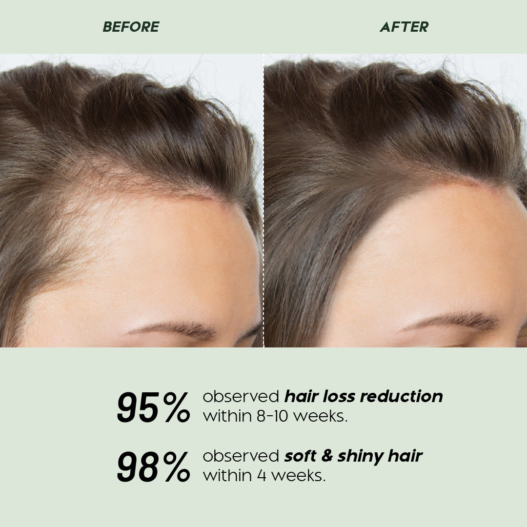 Trulysage Kesh Amrit Taila | Ayurvedic Hair Oil for Hair Growth, Hair Fall Control & Scalp Nourishment | Enriched with Bhringraj, Amla, Neem & Coconut Oil | 200 ml