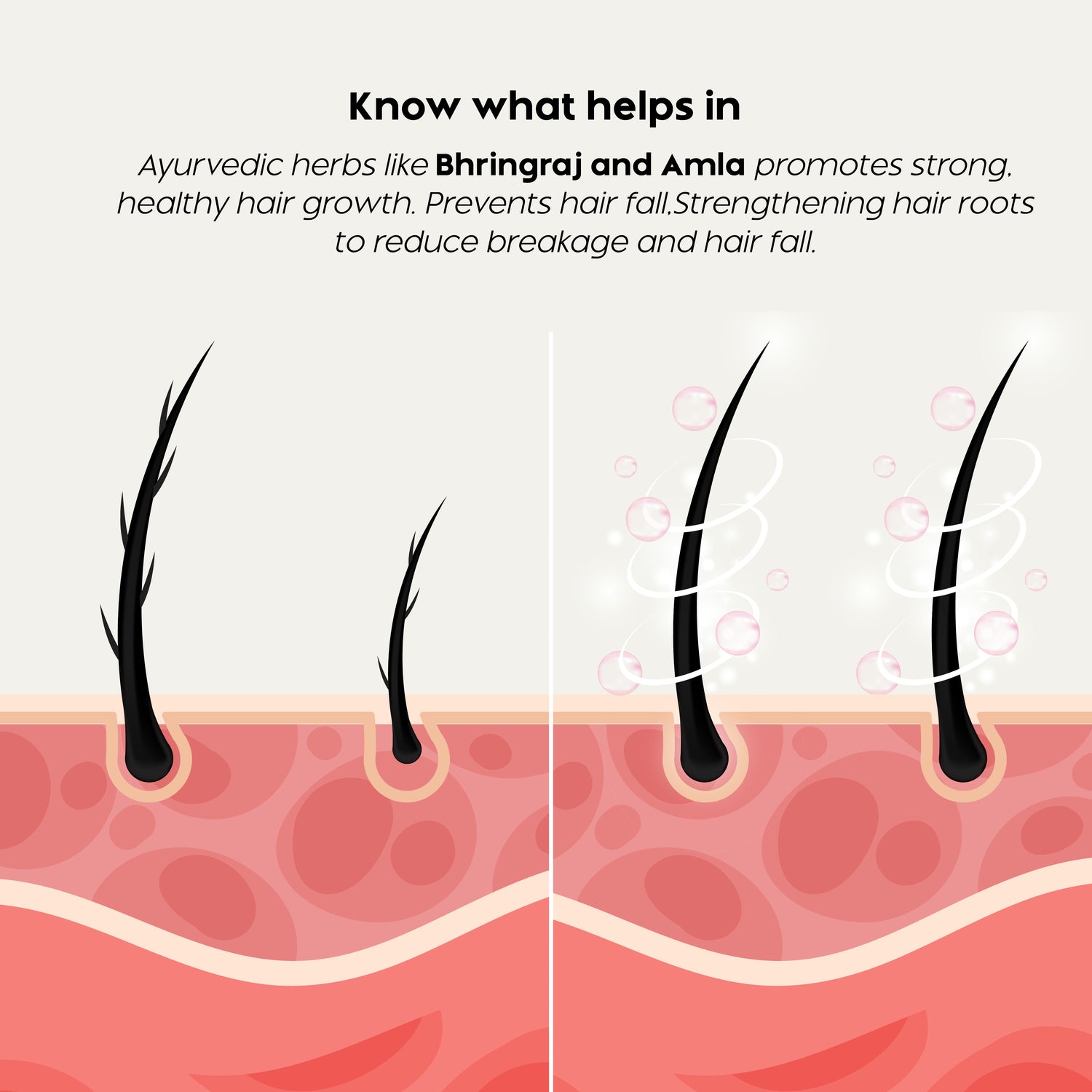 Trulysage Kesh Amrit Taila | Ayurvedic Hair Oil for Hair Growth, Hair Fall Control & Scalp Nourishment | Enriched with Bhringraj, Amla, Neem & Coconut Oil | 200 ml